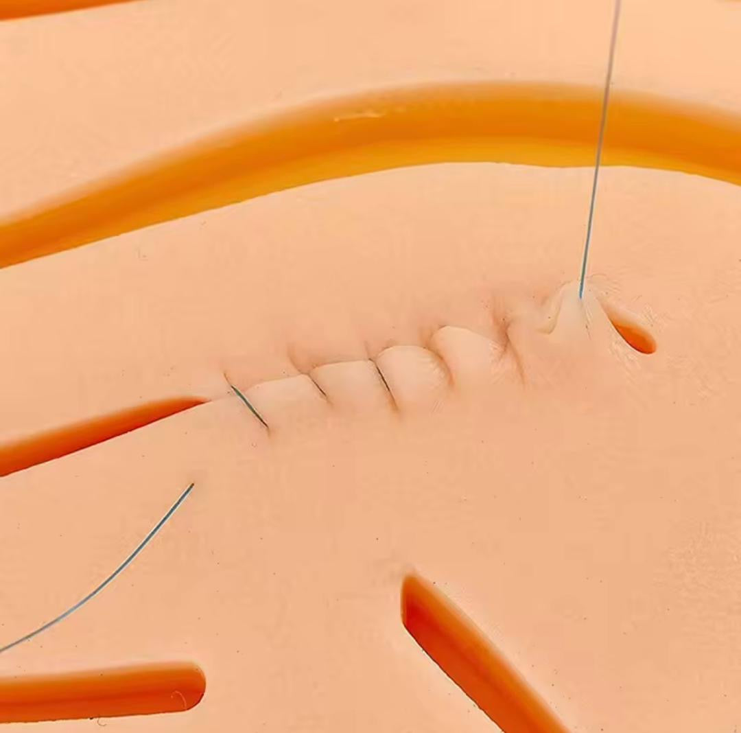 WOUND SUTURES